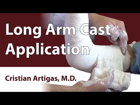 long leg cast application