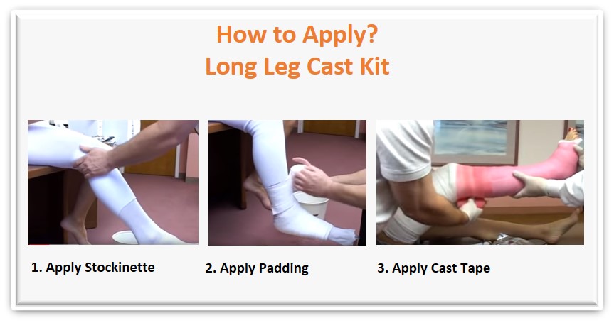 long leg cast application